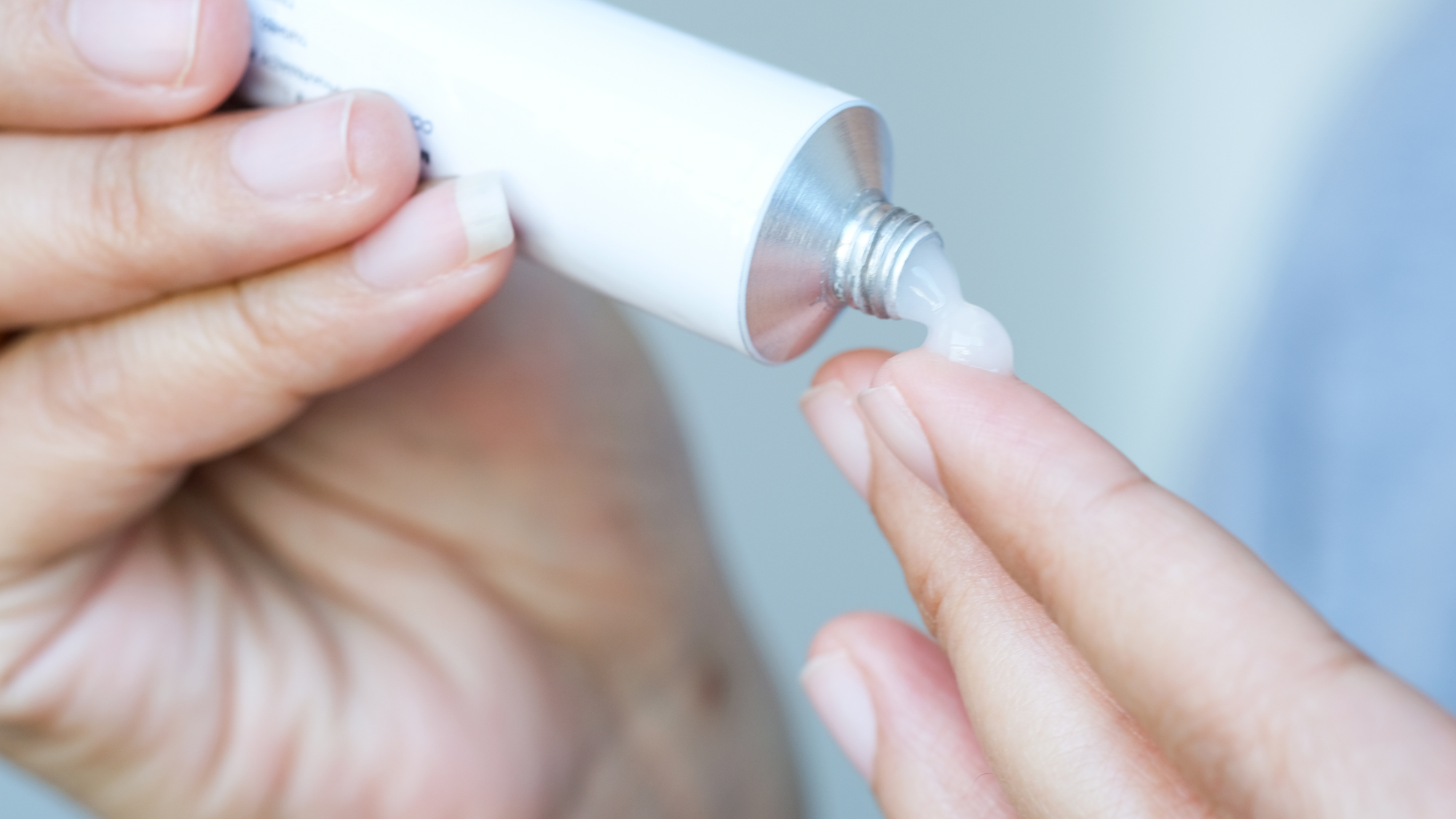 治療濕疹用的類固醇是人工製成的,可以快速消炎減少濕疹不適感。但類固醇並不可以「根治」濕疹,只能夠暫時壓抑炎症。